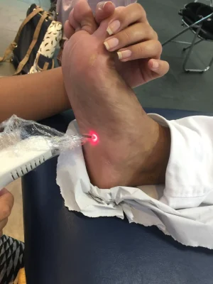 laser (2)