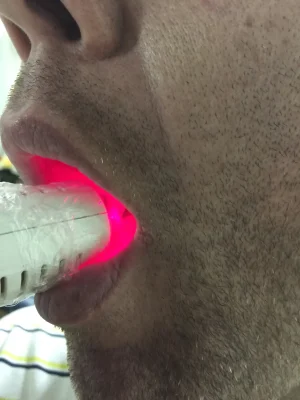 laser (3)